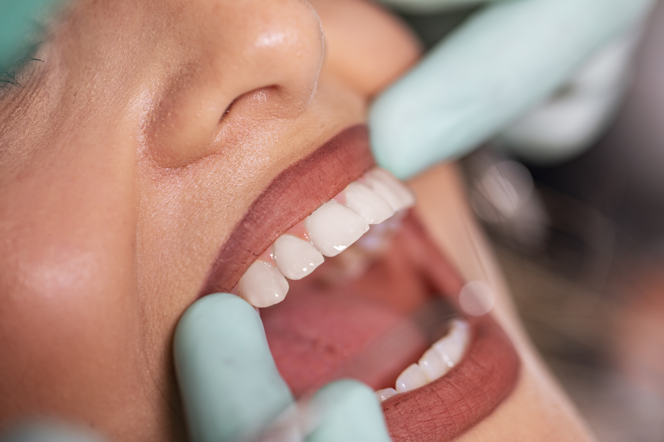 Examination of the teeth