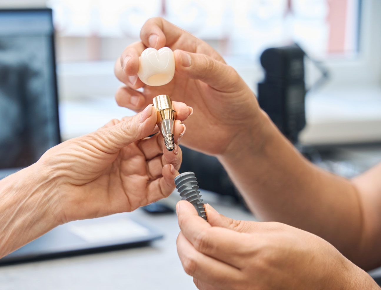 Dentist showing a model of a dental implant